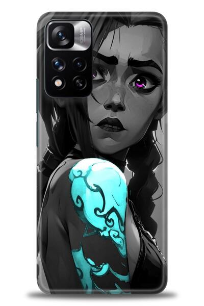 kılıfevreni غطاء متوافق مع هاتف Xiaomi Redmi Note 11 Pro Plus A+ Plus غطاء HD...