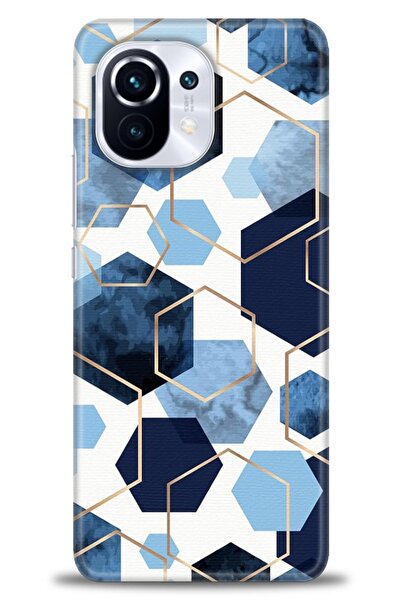 kılıfevreni حافظة متوافقة مع هاتف Xiaomi Mi 11 A+ Plus + واقي شاشة من السيرام...