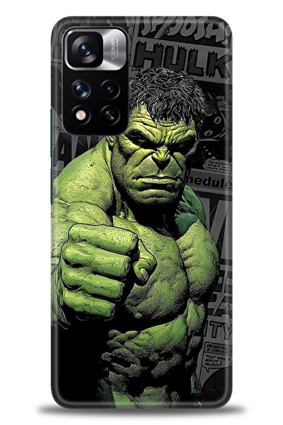 kılıfevreni جراب متوافق مع هاتف Xiaomi Redmi Note 11 Pro Plus + واقي شاشة سير...