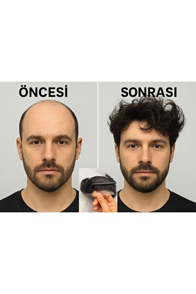 Doruk Hair Luxury Doğal Siyah Protez Gerçek Peruk