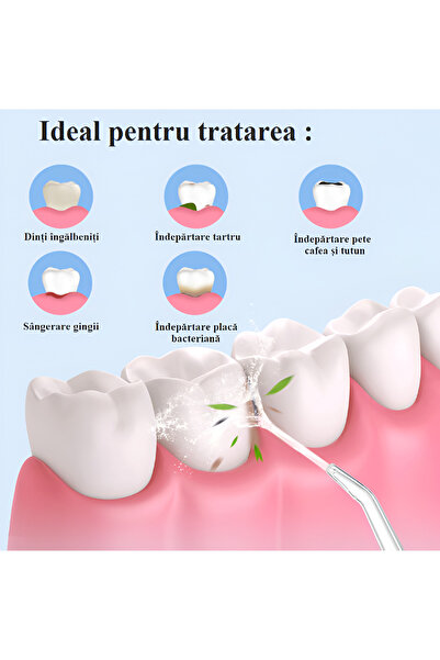NEO Neo™ Στοματικός Πλύτης, Ασύρματος, 3 λειτουργίες, δεξαμενή 230 ml, 1400-1800 παλμοί/λεπτό, Λευκό
