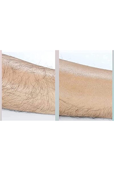 NEO Crystal Friction Epilator, for hair removal and exfoliation, reusable