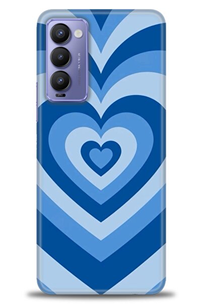 kılıfevreni حافظة متوافقة مع هاتف Tecno Camon 18P + واقي شاشة سيراميك غير قاب...