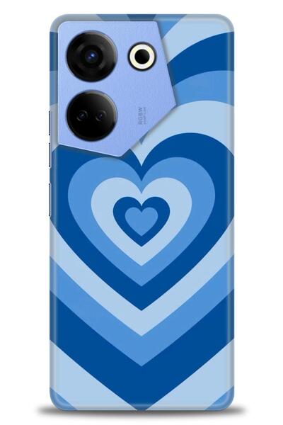 kılıfevreni حافظة تكنو كامون 20 برو 4G متوافقة مع A+ بلس + واقي شاشة سيراميك ...