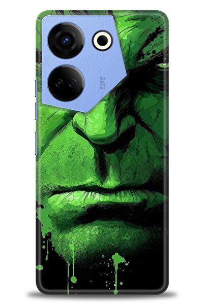 kılıfevreni حافظة تكنو كامون 20 برو 4G متوافقة مع A+ بلس + واقي شاشة سيراميك ...