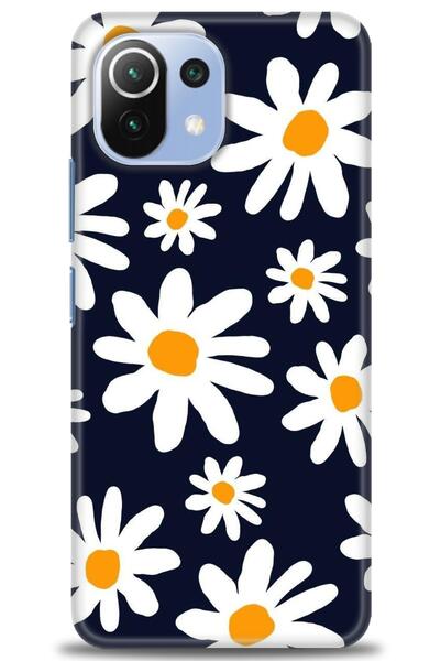 kılıfevreni غطاء متوافق مع هاتف Xiaomi Mi 11 Lite A+ Plus HD مطبوع - غطاء من ...