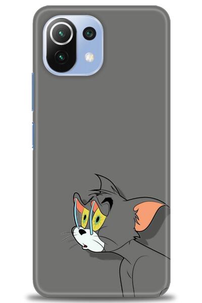 kılıfevreni غطاء متوافق مع هاتف Xiaomi Mi 11 Lite A+ Plus غطاء HD مطبوع - غطا...