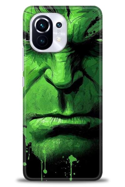 kılıfevreni غطاء مطبوع عالي الدقة متوافق مع هاتف Xiaomi Mi 11 A+ Plus - غطاء ...