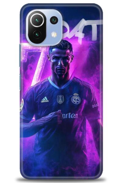 kılıfevreni غطاء متوافق مع هاتف Xiaomi Mi 11 Lite A+ Plus غطاء HD مطبوع - غطا...