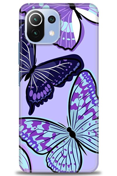 kılıfevreni غطاء متوافق مع هاتف Xiaomi Mi 11 Lite A+ Plus غطاء HD مطبوع - غطا...