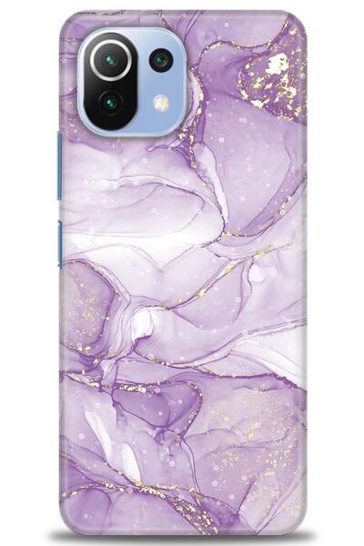 kılıfevreni غطاء متوافق مع هاتف Xiaomi Mi 11 Lite A+ Plus غطاء HD مطبوع - غطا...