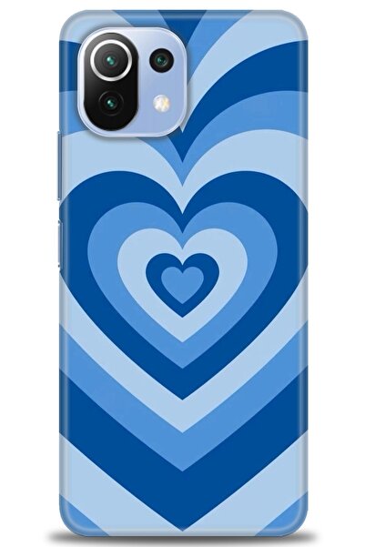 kılıfevreni غطاء متوافق مع هاتف Xiaomi Mi 11 Lite A+ Plus غطاء HD مطبوع - غطا...