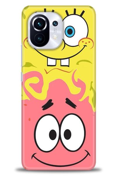 kılıfevreni حافظة متوافقة مع هاتف Xiaomi Mi 11 + واقي شاشة من السيراميك غير ق...