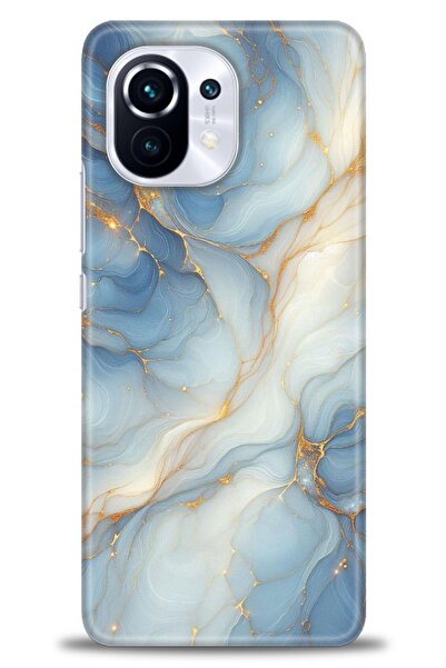 kılıfevreni حافظة متوافقة مع هاتف Xiaomi Mi 11 A+ Plus + واقي شاشة من السيرام...