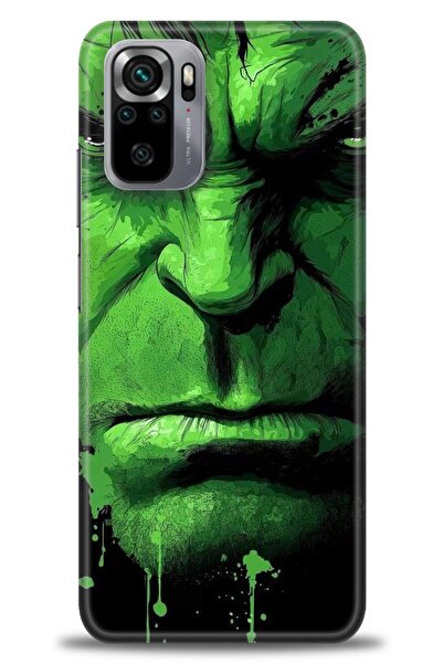 kılıfevreni جراب متوافق مع هاتف Xiaomi Redmi Note 11 SE + واقي شاشة من السيرا...