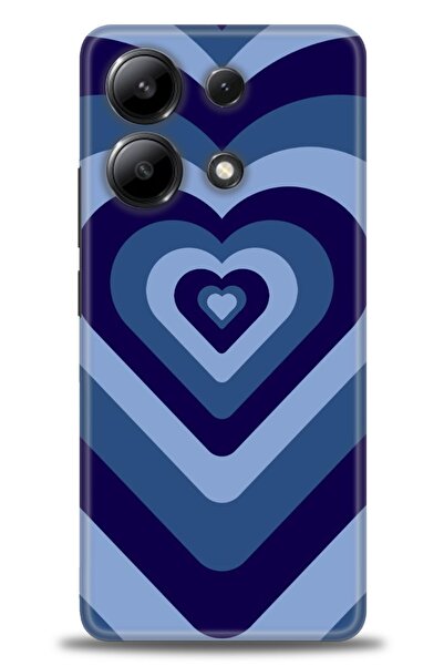 kılıfevreni جراب متوافق مع هاتف Xiaomi Redmi Note 13 4G A+ Plus + واقي شاشة س...