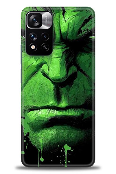 kılıfevreni جراب متوافق مع هاتف Xiaomi Redmi Note 11 Pro Plus + واقي شاشة سير...