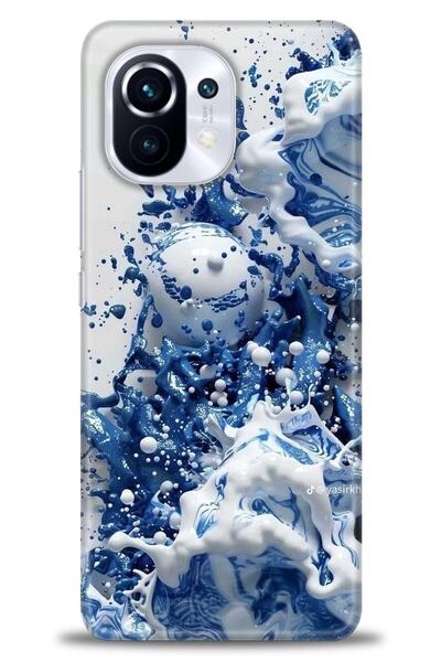 kılıfevreni حافظة متوافقة مع هاتف Xiaomi Mi 11 + واقي شاشة من السيراميك غير ق...