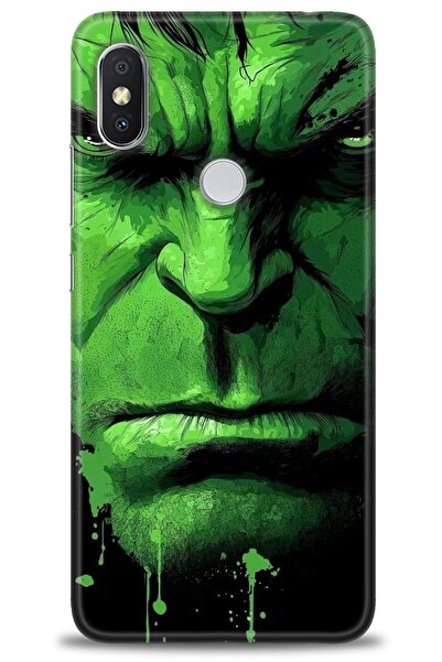 kılıfevreni جراب متوافق مع هاتف Xiaomi Redmi Note 6 Pro + واقي شاشة من السيرا...