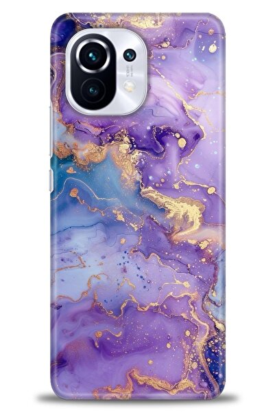 kılıfevreni حافظة متوافقة مع هاتف Xiaomi Mi 11 + واقي شاشة من السيراميك غير ق...