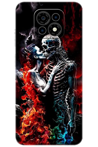 CASPER Via M30 / M30 Plus / M35 Uyumlu Kılıf Desen Baskılı Silikon İskelet Aşıklar STK:666 CP-D2y6e1p