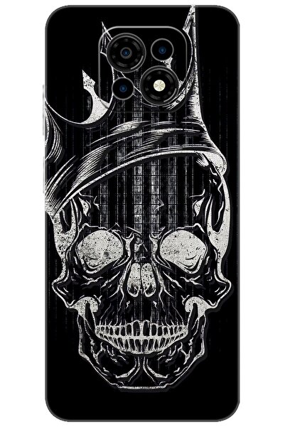 CASPER Via M30 / M30 Plus / M35 Uyumlu Kılıf Desen Baskılı Silikon Kuru Kafa ...