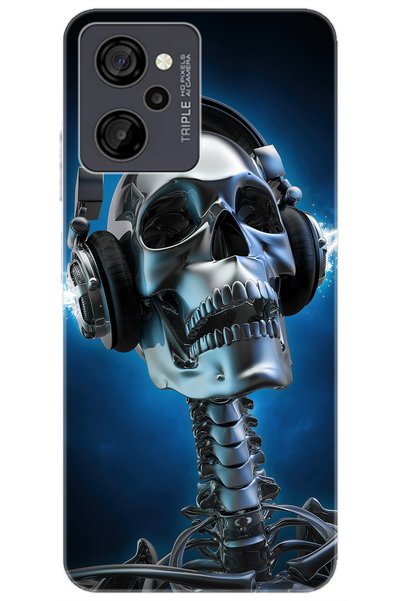 CASPER Via M40 / Via M45 Uyumlu Kılıf Desen Baskılı Silikon Metal İskelet STK...