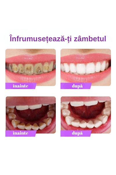 OEM Toothpaste with blueberry extract for whitening and stain removal | 110 ml, SEFUDUN®