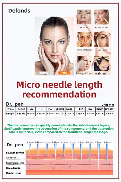 DEFOND إبر متوافقة مع جهاز Dr Pen A6-a10-a1-n2-m5-m7-e30-mym، 10 قطع أصلية، خرطوشة إبر ديرمابن بـ 12 سن