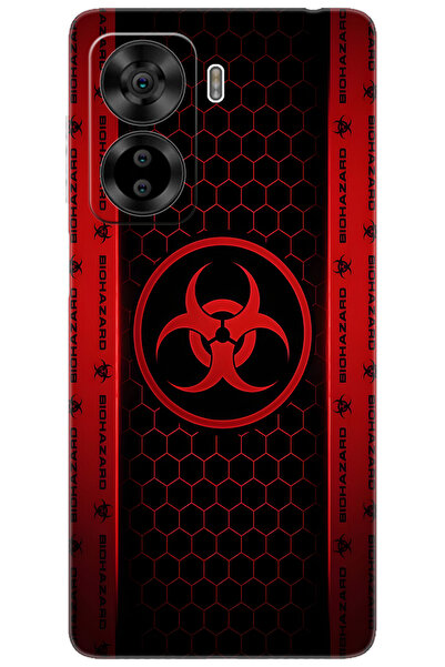 CASPER Via X40 / Via X45 Uyumlu Kılıf Desen Baskılı Silikon Biohazard STK:754...