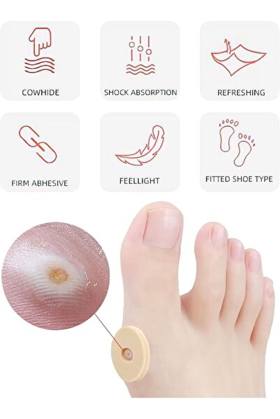 Bunyon Ayak Parmak Taban Nasır Bandı Ağrı Önleyici Delikli Ped Ayakkabı Vurma Önleyici Parmak Koruyucu