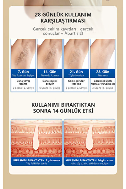 Mlay T16 Milyon Atım Ev Tipi IPL Lazer Epilasyon Cihazı - 3 Başlık (HR+BK+FA) Kaynak üreticisi