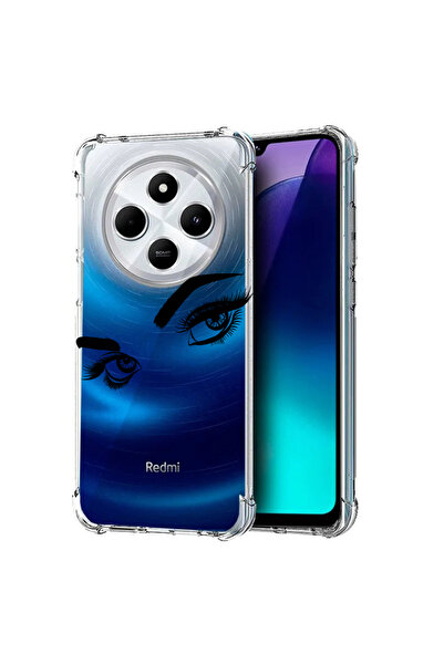 bestcase Carcasă spate antișoc pentru Poco C75 / Redmi 14C / A4, ochi atrăgăt...