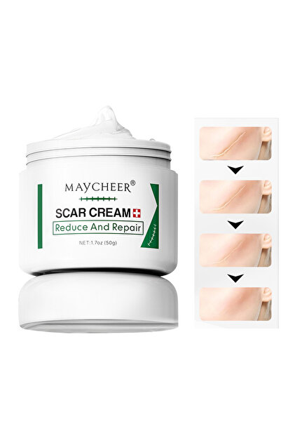 Maycheer كريم الندبات، جل إزالة الندبات، كريم تقليل وإصلاح علامات الجراحة وال...