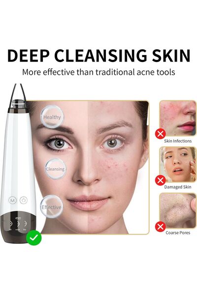 Yelejoy Blackhead Remover Pore Vacuum,3 Suction levels & 6 Suction Probes,for Choice as a Gift