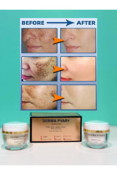 Derma Çil- Güneş Yanığı - Kloazma - Radyasyon Noktaları - Cyasma Karşıtı Beya...