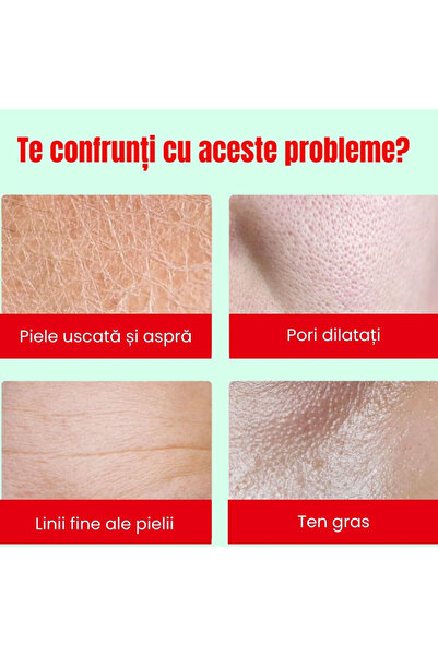 OEM Set of 6 Facial Masks with Plants & Hyaluronic Acid for Hydration ANGELLADY®