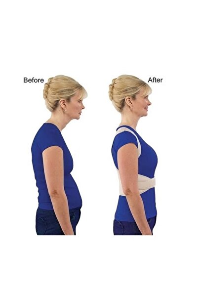 Generic Posture Corrector Activator Brace Size S-M