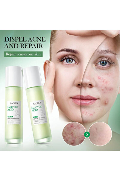 SADOER Salicylic Acid Face Care for Acne 100 ml