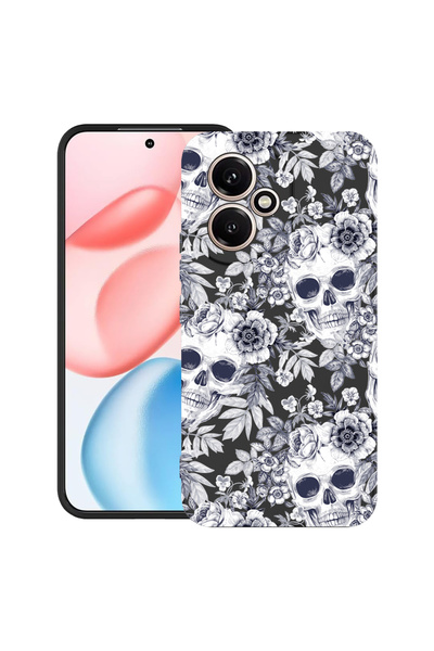 bestcase Θήκη TPU εξαιρετικά λεπτή για Honor 400, Skull μαύρο και άσπρο, 2060...