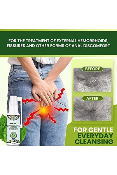 EELHOE Natural Herbal Spray for Quick and Effective Hemorrhoid and Anal Fissure Treatment (3 Pieces)
