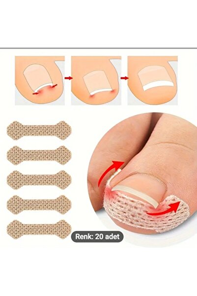 AIROPE Batık Tırnak Flasteri 20'li paket