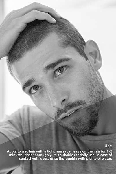 Bioxcin Klasik Yağlı Saçlar Için Şampuan 300 ml-