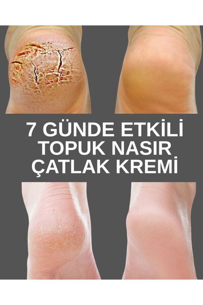 BİO SHOES Nasirx Topuk Nasir Sökücü Krem
