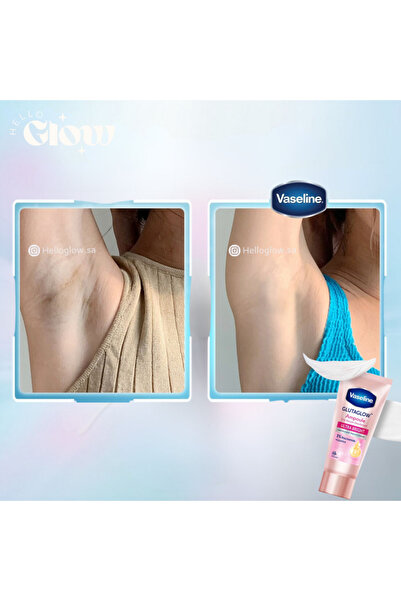 Vaseline Dry Serum GlutaGlow Ampoule Deodorant Ultra Bright 30 Ml