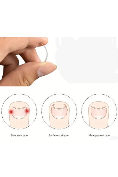 ErCorp BAŞ PARMAK TIRNAK BATMASINI ENGELLEYEN METAL APARAT NRD 603
