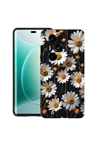 bestcase Carcasă ultrasubțire din TPU pentru Honor 300 Pro / 300 Ultra, model...