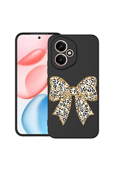bestcase Carcasă ultra subțire TPU pentru Honor 400, model leopard, 2060076 B...
