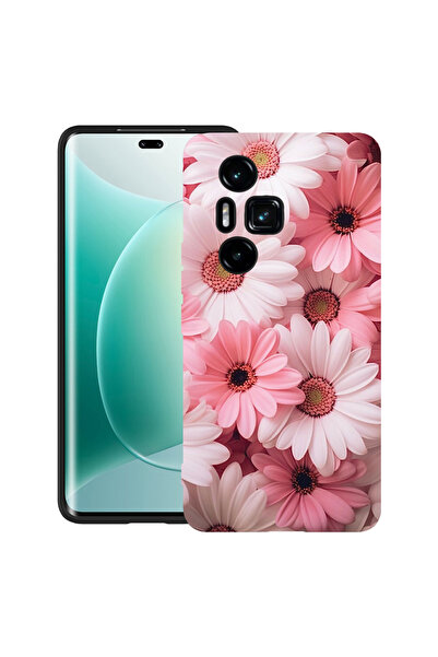 bestcase Carcasă ultra subțire TPU mat pentru Honor 300 Pro / 300 Ultra, roz ...