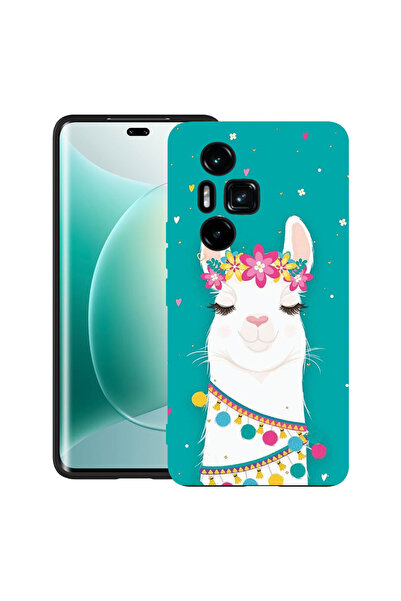 bestcase Carcasă ultra subțire din TPU pentru Honor 300 Pro / 300 Ultra, Love...